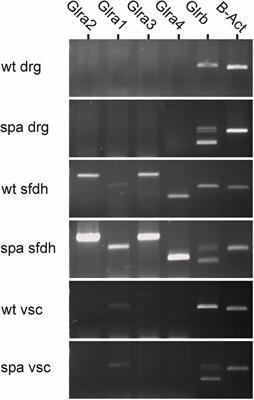 Nociception in the Glycine Receptor Deficient Mutant Mouse Spastic